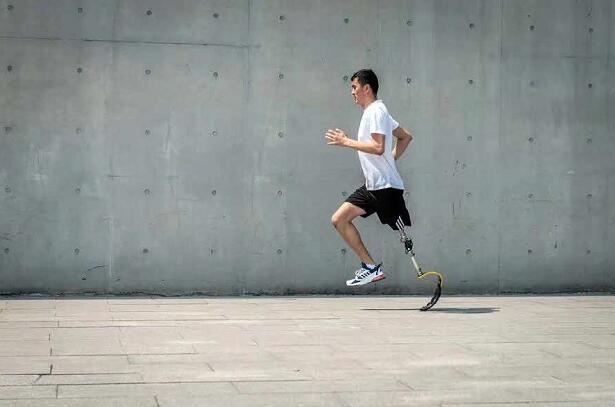 假肢廠家淺談下肢假肢如何做好護理工作(圖1) 假肢價格