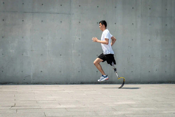 假肢患者如何在短時(shí)間內(nèi)做好殘肢定型?(圖1) 假肢廠家