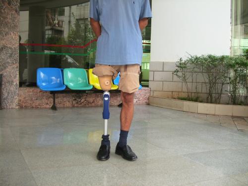 如何選對廠家安裝合適的假肢?(圖2) 假肢