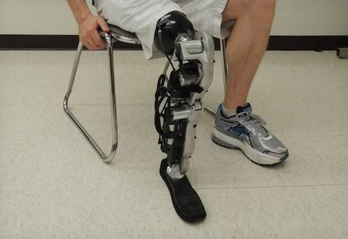 如何理性對(duì)待避免安裝劣質(zhì)假肢?(圖1) 假肢